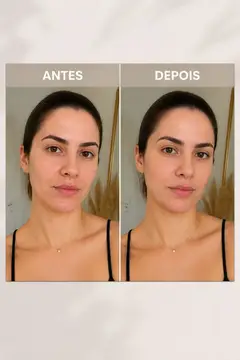 Antes e depois — Estética & beleza