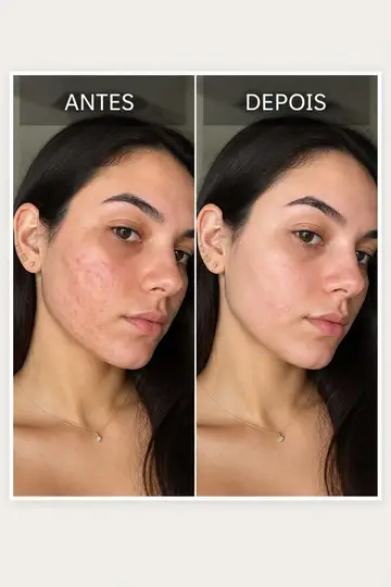Antes e depois lado a lado